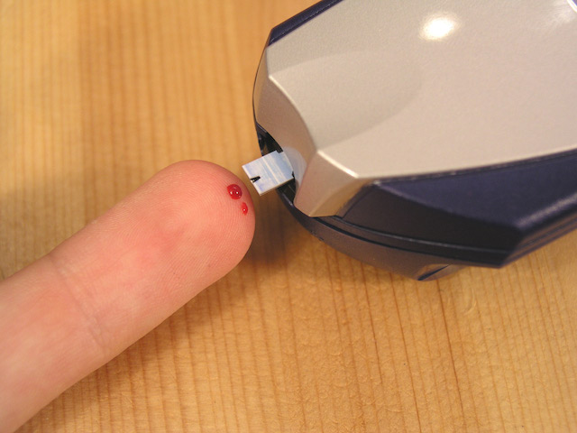 Malays, Indians with Type 2 diabetes have higher risk of heart attacks & strokes