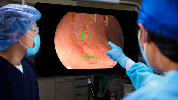 AI used to improve colorectal cancer screening results